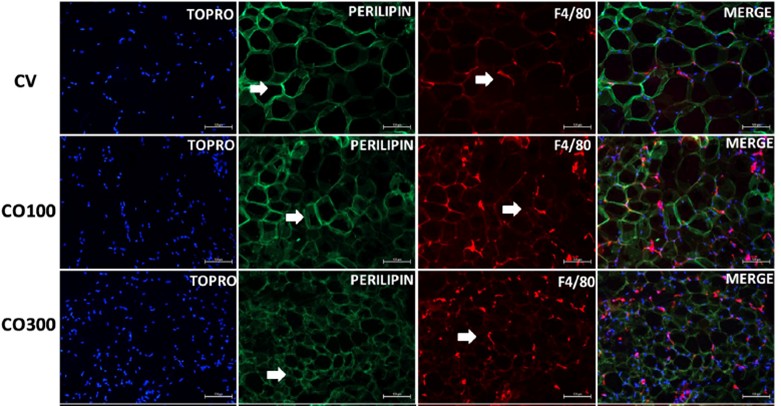 Obesidade, ansiedade e inflamações: entenda como suplemento de óleo de coco pode se tornar 'vilão' na dieta